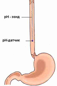 pH-метрия для определения кислотности